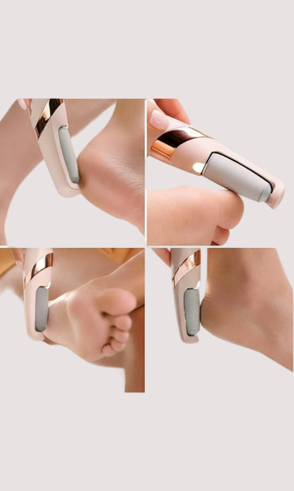 Bos Medicare Cordless Pedicure Callus Dead Skin Remover